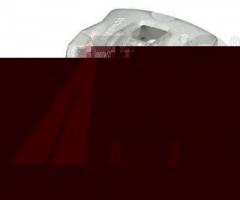 A.b.s. 726131 zacisk hamulc. kia sportage  04-10 lewy tył, hyundai tucson (jm)