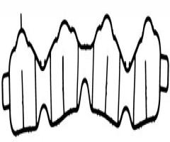 Reinz 71-38218-00 uszczelka kolektora ssąc. opel, chevrolet cruze (j300), opel astra j sports tourer