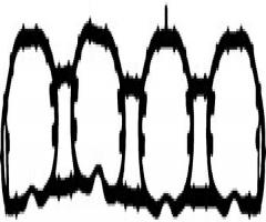 Reinz 71-37583-00 uszczelka kolektora ssąc. audi, audi a5 kabriolet (8f7), seat altea xl (5p5, 5p8)